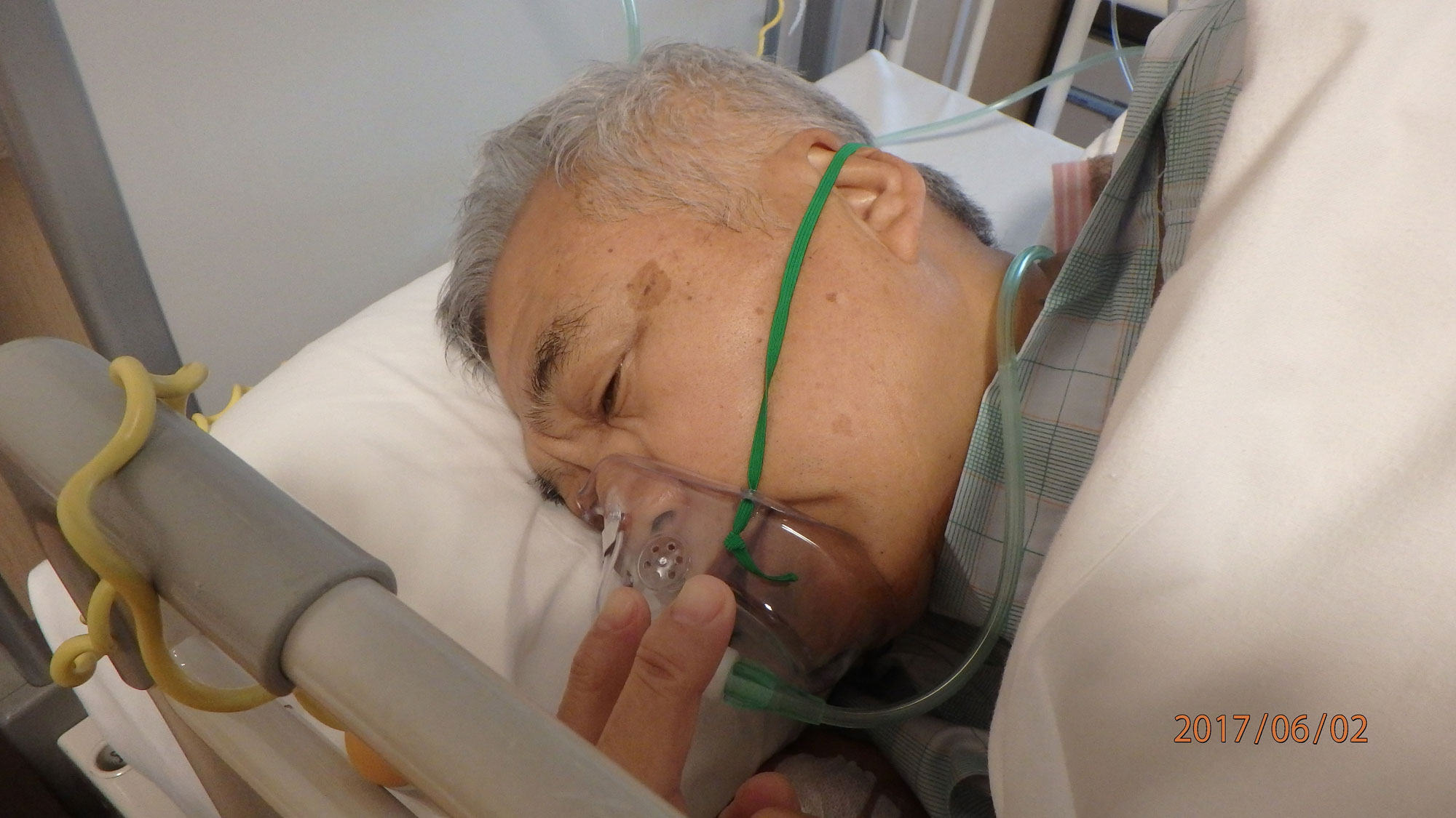 酸素マスク使用中